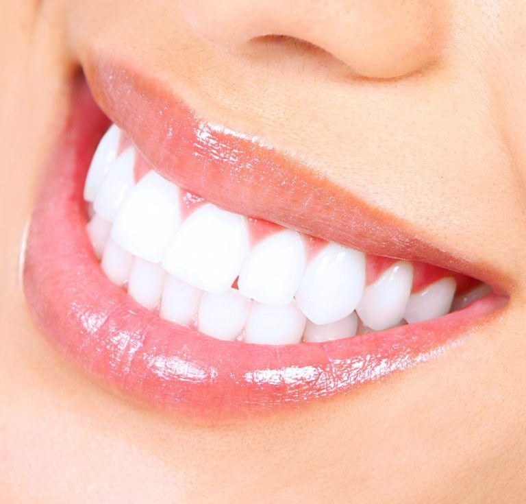 Best Dental Clinic in Bangalore