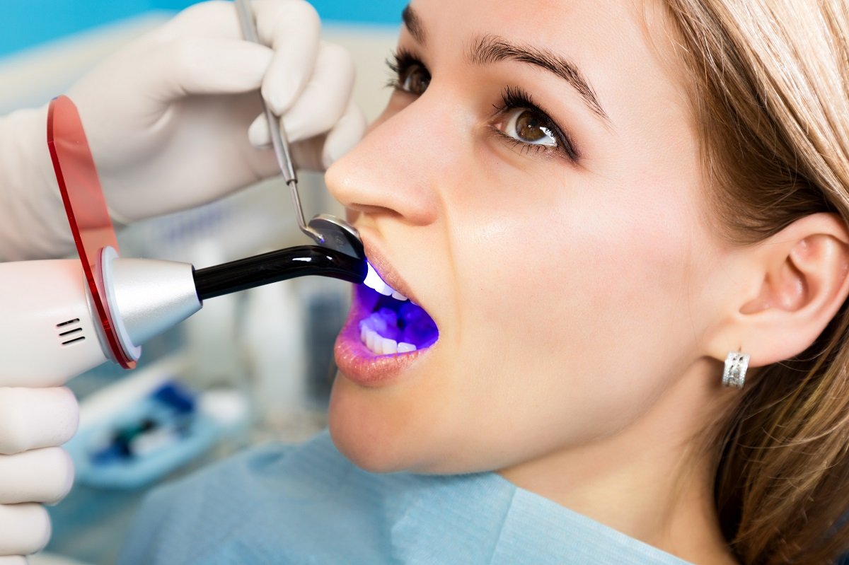 Best Dental Clinic in Bangalore