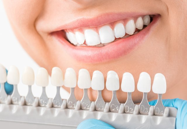 Best Dental Clinic in Bangalore