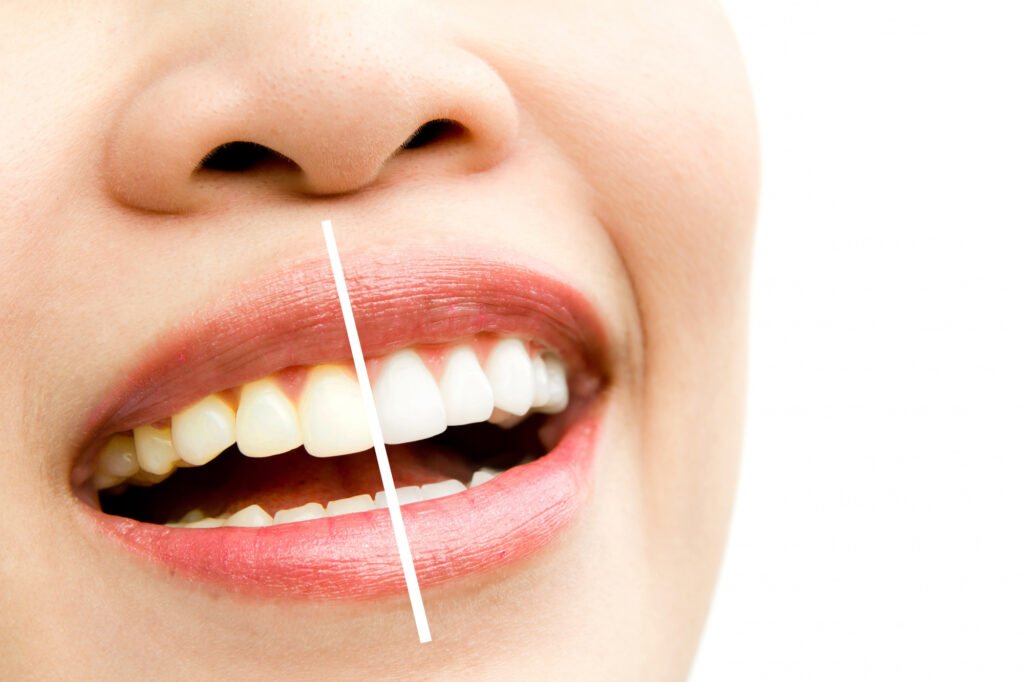 Best Dental Clinic in Bangalore