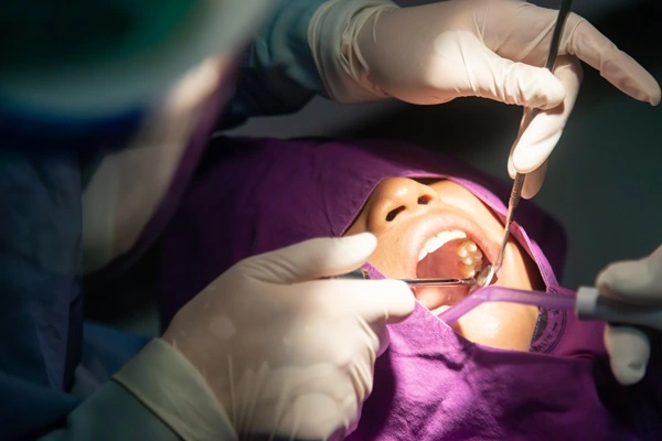 best wisdom teeth removal in Bangalore