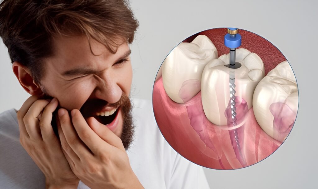 Comparison of root canal treated tooth and dental implant procedure