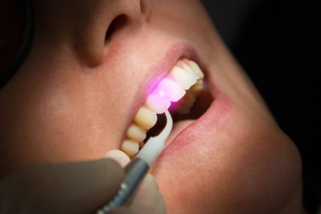 Patients receiving comfortable laser dental treatment at Archak Dental Clinic Bengaluru