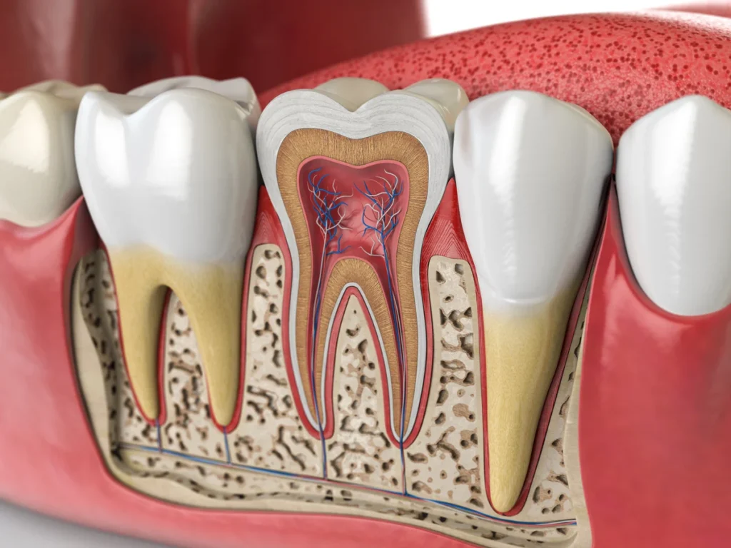 Can a Failed Root Canal Be Fixed Without Extraction?