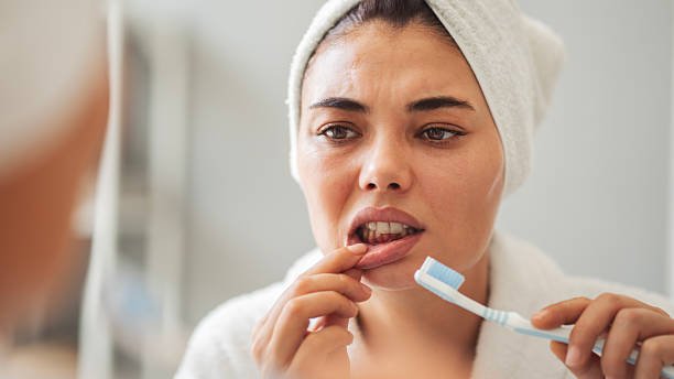 Why Your Gums Bleed Even After Using a Soft Toothbrush