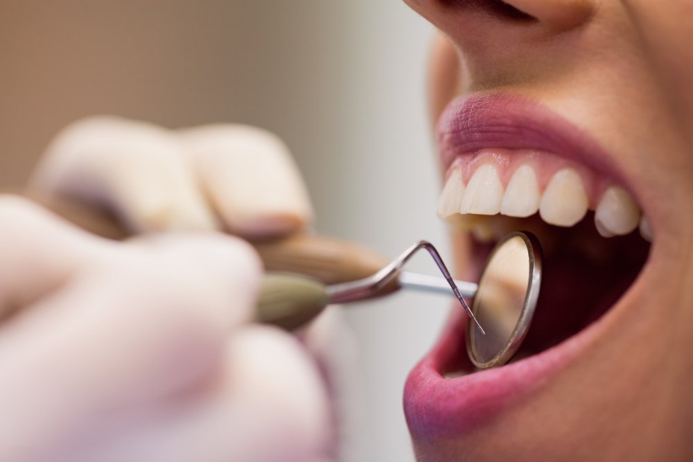 Best Dental Clinic in Bangalore