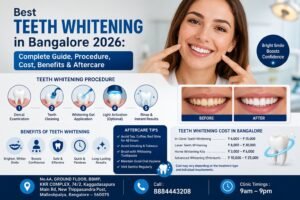 Best Teeth Whitening in Bangalore 2026: Complete Guide, Procedure, Cost, Benefits & Aftercare